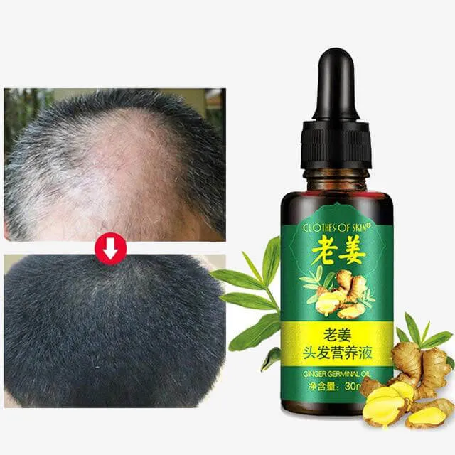 7 Days Serum Treat Hair Loss Provide Nutrition Dry Damaged Hairs Thick Enhancement